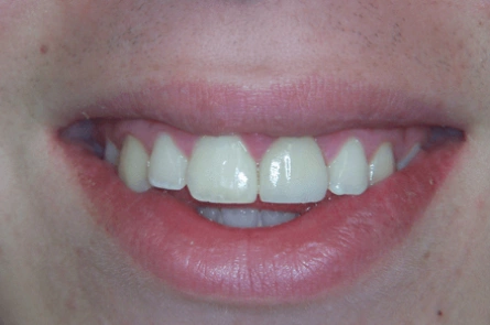 After