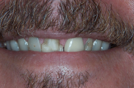 Before