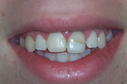 Before