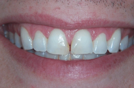 Before